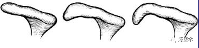 高清影像图解肩关节解剖及诊断