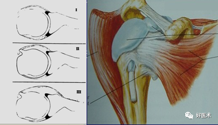 高清影像图解肩关节解剖及诊断