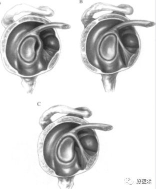 高清影像图解肩关节解剖及诊断