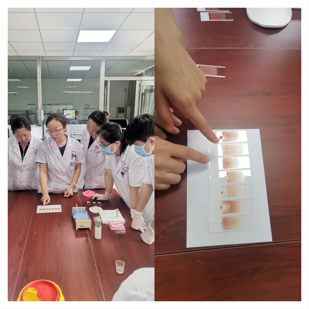 职业病防治院工会举办血涂片推片技能竞赛