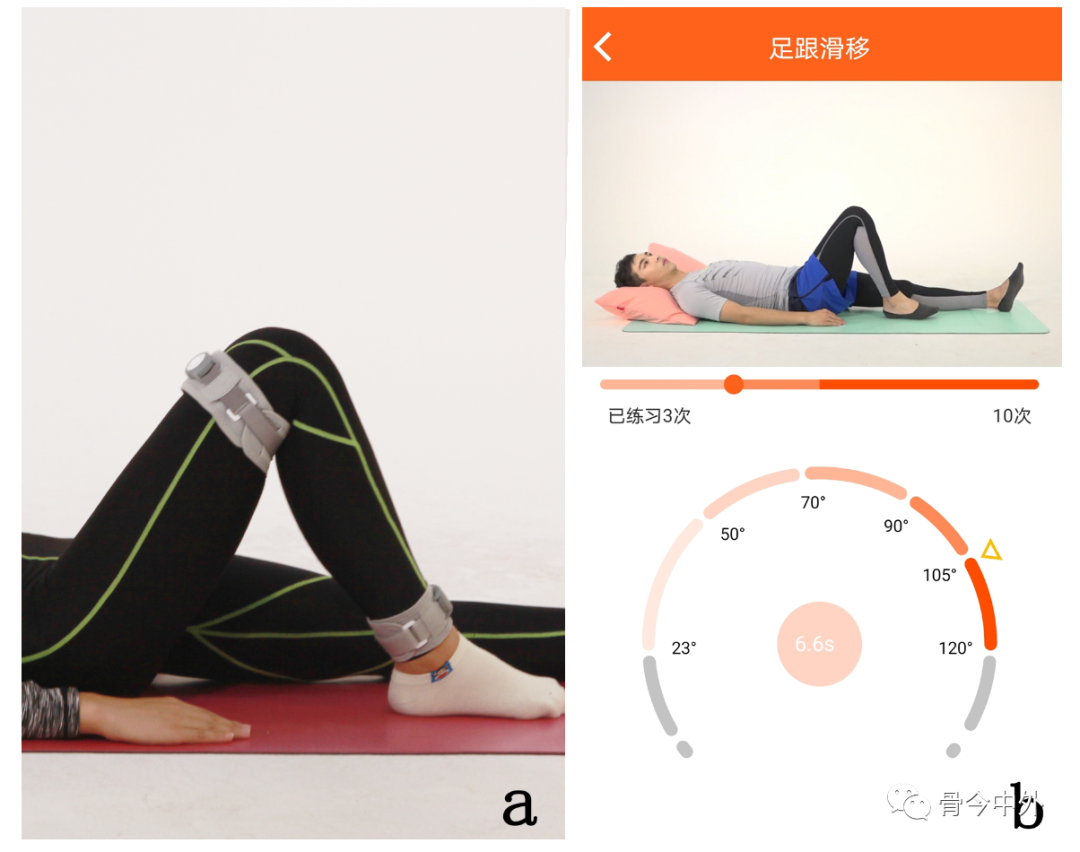 康复器械产品怎么找两款骨科康复创新医疗器械荣登北京市创新等高精尖医疗器械产品名单_https://www.jmylbn.com_新闻资讯_第4张