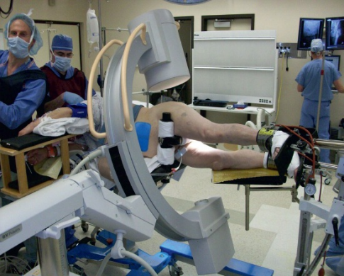 什么是c型臂术中透视骨科精读 ｜ 股骨近端骨折的转子区域与矢状面力线术中透视技巧_https://www.jmylbn.com_新闻资讯_第25张