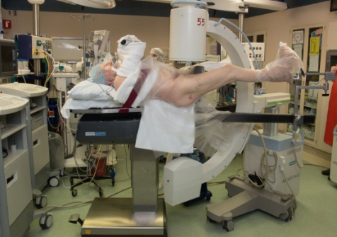 什么是c型臂术中透视骨科精读 ｜ 股骨近端骨折的转子区域与矢状面力线术中透视技巧_https://www.jmylbn.com_新闻资讯_第3张