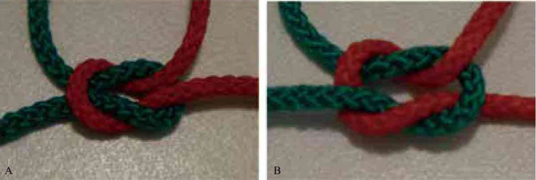 缝伤口怎么打结骨科打结的常用手法大全，你了解多少？_https://www.jmylbn.com_新闻资讯_第14张