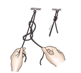 缝伤口怎么打结骨科打结的常用手法大全，你了解多少？_https://www.jmylbn.com_新闻资讯_第25张