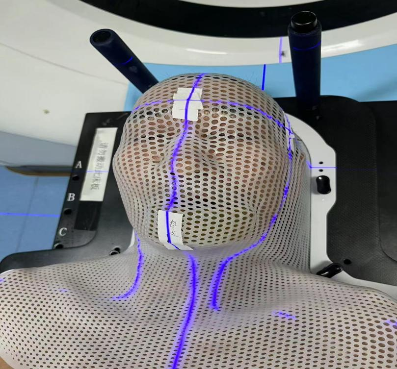 放疗做膜是什么意思【肿瘤中心 健康科普】放射治疗患者体位固定须知_https://www.jmylbn.com_新闻资讯_第3张