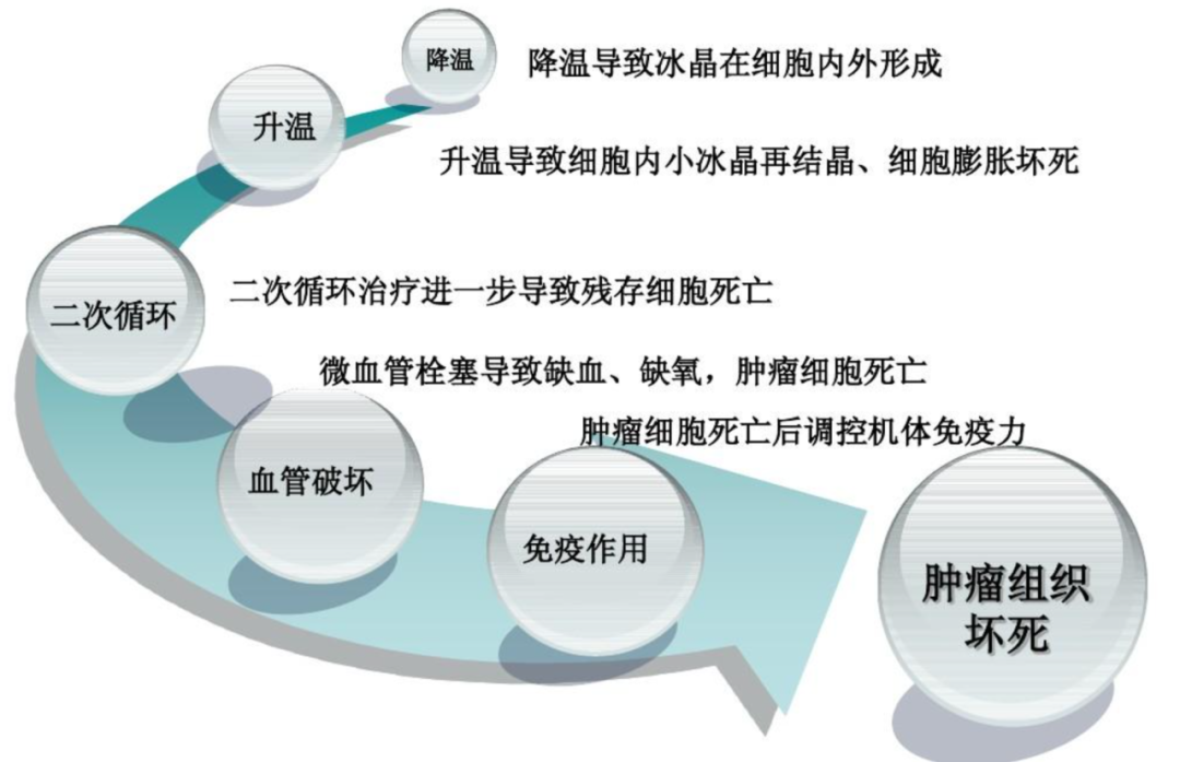 氦氩刀是什么“冰火两重天”，氩氦刀“杀死”肿瘤_https://www.jmylbn.com_新闻资讯_第6张