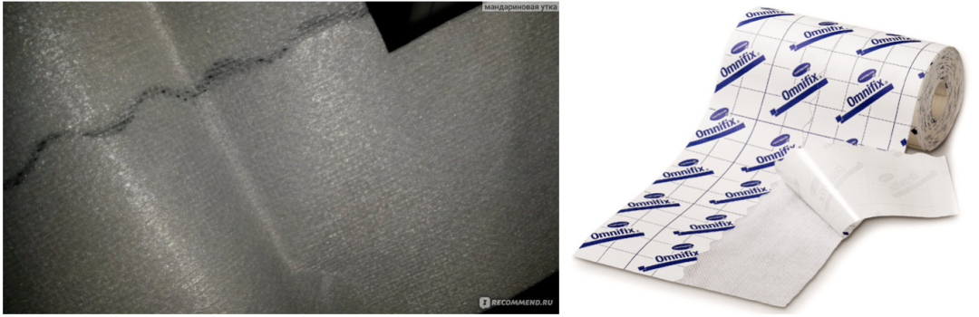 人工敷料怎么照顾伤口【伤口造口】二层敷料的选择和使用_https://www.jmylbn.com_新闻资讯_第4张