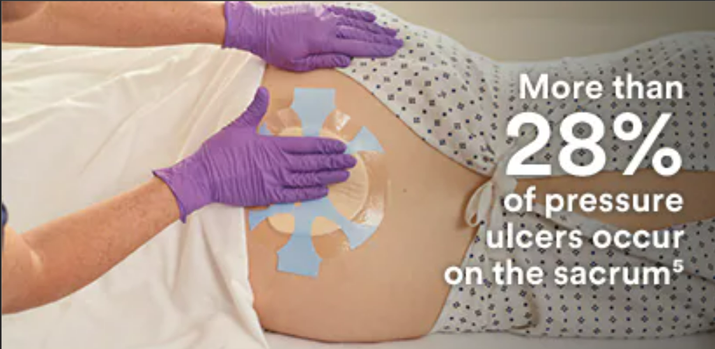 性敷料是什么硅酮粘性多层泡沫敷料作为预防院内获得性压疮的辅助预防治疗_https://www.jmylbn.com_新闻资讯_第1张