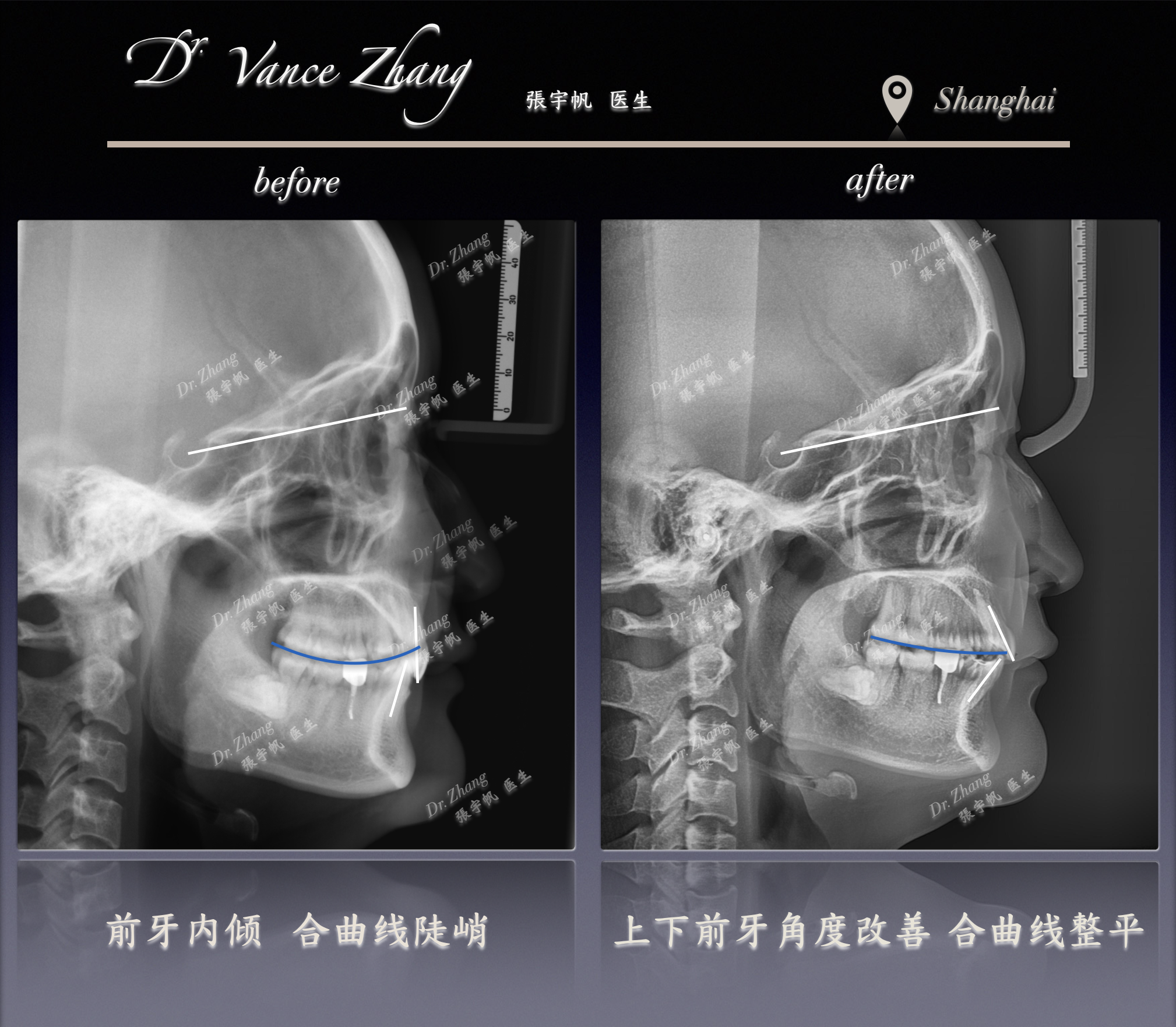 深覆合的健康隐患正式病例贴图15