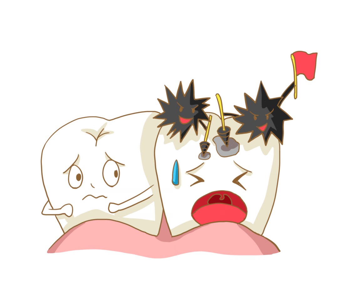 蛀牙,口腔中的"沉默杀手",它会悄无声息地侵蚀着我们的牙齿.