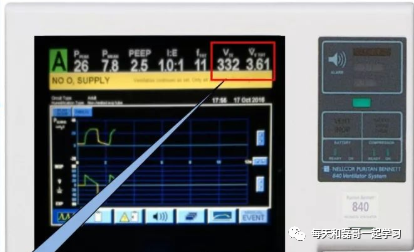 为什么成人呼吸机用容控重症技术之机械通气（九）-呼吸机监测及呼吸力学测量_https://www.jmylbn.com_新闻资讯_第5张