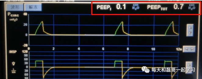 为什么成人呼吸机用容控重症技术之机械通气（九）-呼吸机监测及呼吸力学测量_https://www.jmylbn.com_新闻资讯_第12张