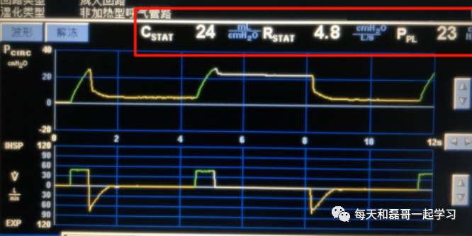 为什么成人呼吸机用容控重症技术之机械通气（九）-呼吸机监测及呼吸力学测量_https://www.jmylbn.com_新闻资讯_第11张