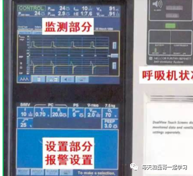 为什么成人呼吸机用容控重症技术之机械通气（九）-呼吸机监测及呼吸力学测量_https://www.jmylbn.com_新闻资讯_第1张