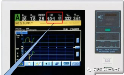 为什么成人呼吸机用容控重症技术之机械通气（九）-呼吸机监测及呼吸力学测量_https://www.jmylbn.com_新闻资讯_第4张