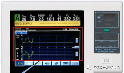 为什么成人呼吸机用容控重症技术之机械通气（九）-呼吸机监测及呼吸力学测量_https://www.jmylbn.com_新闻资讯_第7张