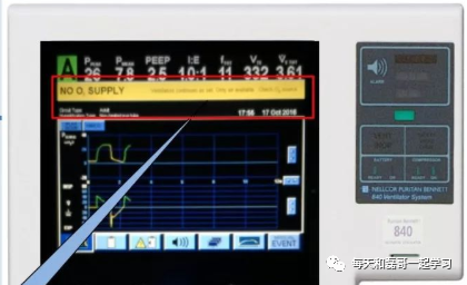 为什么成人呼吸机用容控重症技术之机械通气（九）-呼吸机监测及呼吸力学测量_https://www.jmylbn.com_新闻资讯_第6张