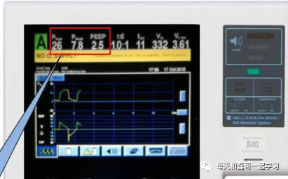 为什么成人呼吸机用容控重症技术之机械通气（九）-呼吸机监测及呼吸力学测量_https://www.jmylbn.com_新闻资讯_第3张