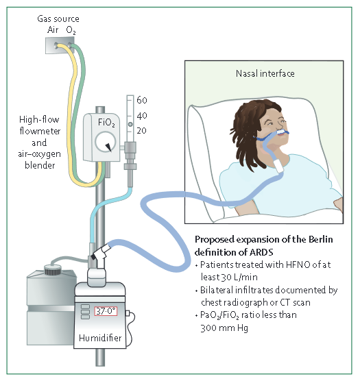吸氧管怎么接重症疾病之急性呼吸窘迫综合征（三十）-ARDS文献回顾-急性呼吸窘迫综合征的柏林定义：应包括接受高流量鼻导管吸氧的患者？_https://www.jmylbn.com_新闻资讯_第2张