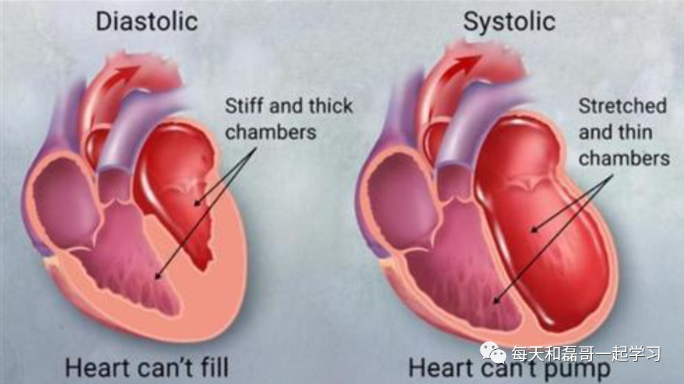 机械通气的指征是什么重症技术之机械通气（二）-指征、禁忌、对心脏前后负荷影响_https://www.jmylbn.com_新闻资讯_第4张