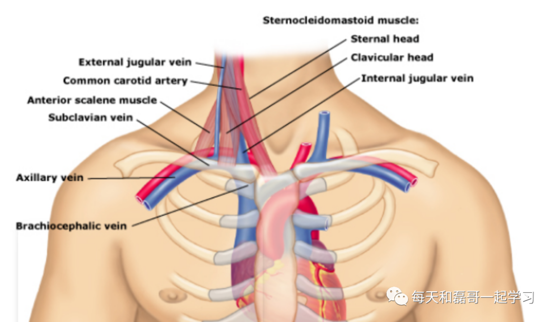 什么是中心静脉导管重症技术之中心静脉导管（一）_https://www.jmylbn.com_新闻资讯_第2张