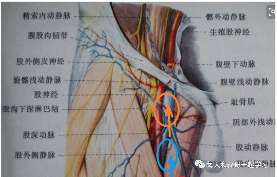 什么是中心静脉导管重症技术之中心静脉导管（一）_https://www.jmylbn.com_新闻资讯_第3张