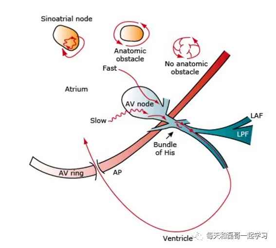 为什么选择双相波重症技术之电复律、除颤术（一）_https://www.jmylbn.com_新闻资讯_第5张