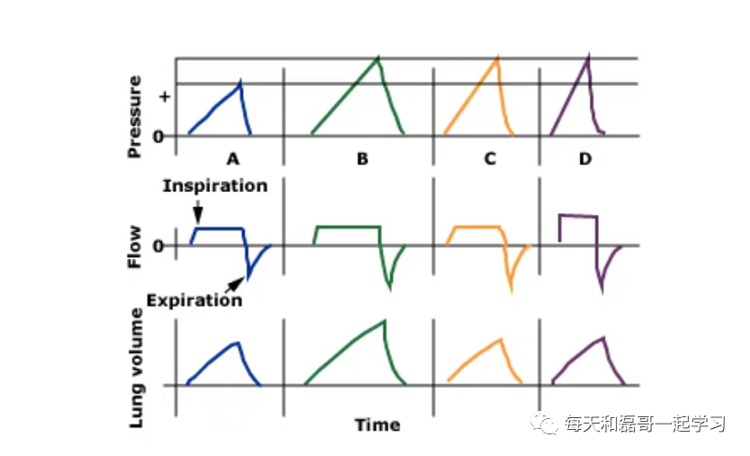 指令通气模式有哪些重症技术之机械通气（十）-机械通气模式-1-定容通气_https://www.jmylbn.com_新闻资讯_第3张