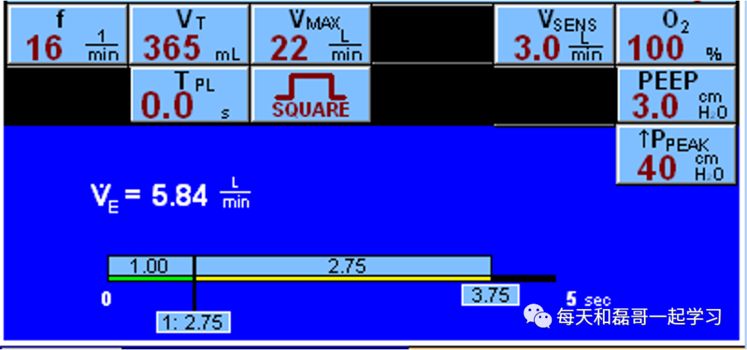 指令通气模式有哪些重症技术之机械通气（十）-机械通气模式-1-定容通气_https://www.jmylbn.com_新闻资讯_第2张