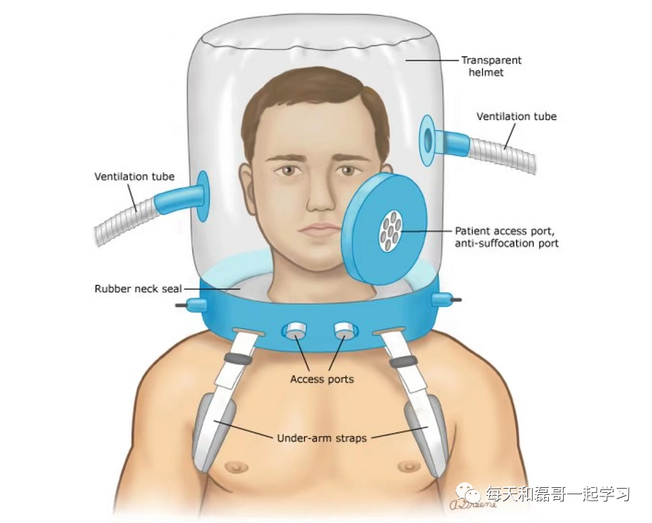 呼吸机ac是什么意思重症技术之机械通气（三十七）-ARDS呼吸机治疗策略_https://www.jmylbn.com_新闻资讯_第1张