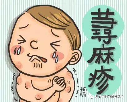 药店专业用药方案：荨麻疹的治疗与联合用药方案-335