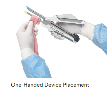 强生吻合器怎么样正式亮相！强生首款线性手术吻合器_https://www.jmylbn.com_新闻资讯_第5张