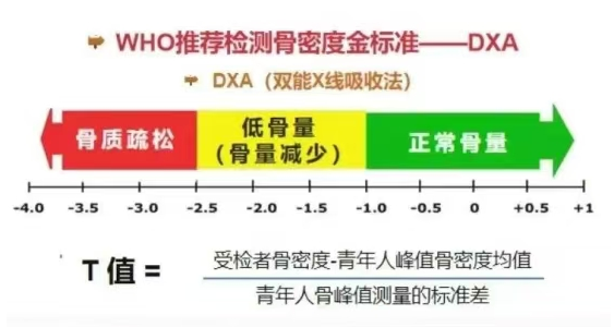 双能x骨密度检测仪为什么非得输入体重身高人医科普 ｜ 骨质疏松诊断“金标准”：双能X线骨密度仪_https://www.jmylbn.com_新闻资讯_第12张