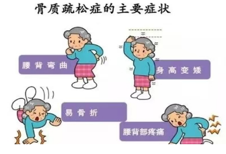 双能x骨密度检测仪为什么非得输入体重身高人医科普 ｜ 骨质疏松诊断“金标准”：双能X线骨密度仪_https://www.jmylbn.com_新闻资讯_第8张