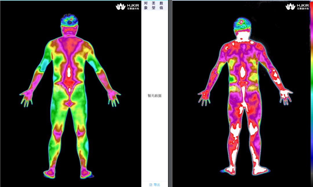 华景康红外赋能热疗领域应用—可视化效果评估
