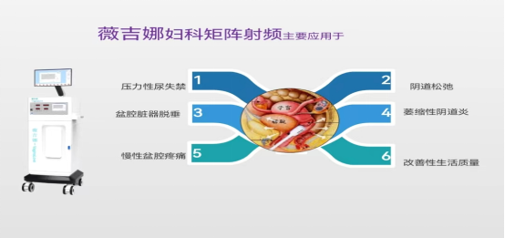 射频妇科是什么济南市莱芜人民医院：射频治疗仪重启女性私密少女感_https://www.jmylbn.com_新闻资讯_第4张