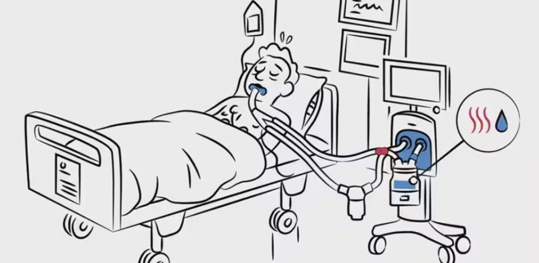 呼吸机湿化罐怎么加水谢克亮教授：ICU机械通气中的湿化与感控_https://www.jmylbn.com_新闻资讯_第3张