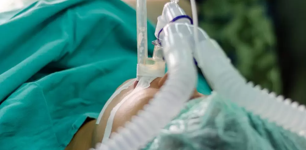 呼吸机湿化罐怎么加水谢克亮教授：ICU机械通气中的湿化与感控_https://www.jmylbn.com_新闻资讯_第2张