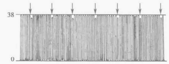 病人监测仪怎么看小小曲线，大大奥秘｜监护仪上每天都看的SpO2与PETCO2，除了数值还要关注什么？_https://www.jmylbn.com_新闻资讯_第10张