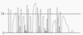 病人监测仪怎么看小小曲线，大大奥秘｜监护仪上每天都看的SpO2与PETCO2，除了数值还要关注什么？_https://www.jmylbn.com_新闻资讯_第11张