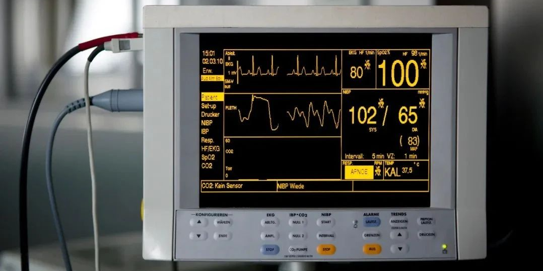 病人监测仪怎么看小小曲线，大大奥秘｜监护仪上每天都看的SpO2与PETCO2，除了数值还要关注什么？_https://www.jmylbn.com_新闻资讯_第1张