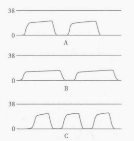 病人监测仪怎么看小小曲线，大大奥秘｜监护仪上每天都看的SpO2与PETCO2，除了数值还要关注什么？_https://www.jmylbn.com_新闻资讯_第5张