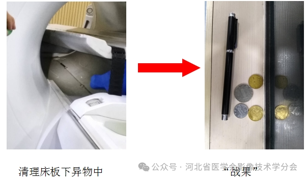 磁共振设备多少钱磁共振设备知多少？_https://www.jmylbn.com_品牌排行榜_第8张