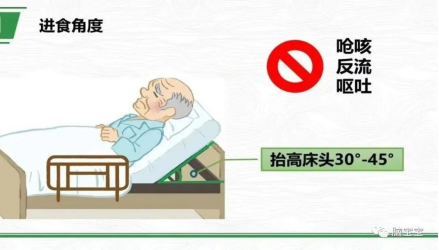 鼻饲胃管什么牌子的好鼻饲饮食患者需要注意什么？_https://www.jmylbn.com_新闻资讯_第8张