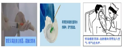 鼻饲胃管什么牌子的好鼻饲饮食患者需要注意什么？_https://www.jmylbn.com_新闻资讯_第3张