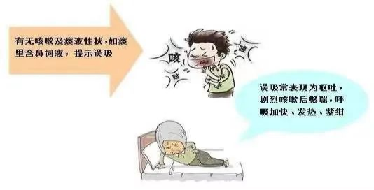 鼻饲胃管什么牌子的好鼻饲饮食患者需要注意什么？_https://www.jmylbn.com_新闻资讯_第13张