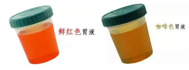 鼻饲胃管什么牌子的好鼻饲饮食患者需要注意什么？_https://www.jmylbn.com_新闻资讯_第10张