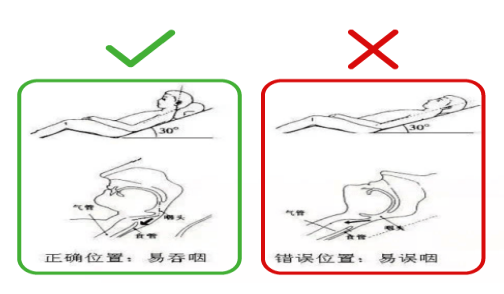 鼻饲胃管什么牌子的好鼻饲饮食患者需要注意什么？_https://www.jmylbn.com_新闻资讯_第4张