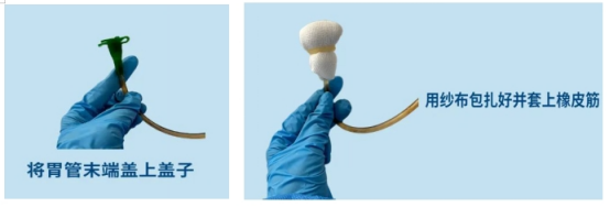 鼻饲胃管什么牌子的好鼻饲饮食患者需要注意什么？_https://www.jmylbn.com_新闻资讯_第11张